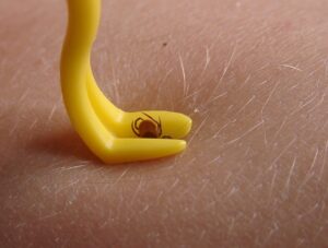 Les tiques, comment les retirer ? arton6575-081